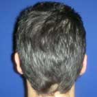 ΩΤΟΠΛΑΣΤΙΚΗ, ΠΛΑΣΤΙΚΗ ΑΥΤΙΩΝ, ΠΛΑΣΤΙΚΗ ΧΕΙΡΟΥΡΓΙΚΗ ΑΥΤΙΩΝ,ΠΛΑΣΤΙΚΗ ΣΤΑ ΑΥΤΙΑ, ΠΕΤΑΧΤΑ ΑΥΤΙΑ, ΑΦΕΣΤΩΤΑ ΩΤΑ